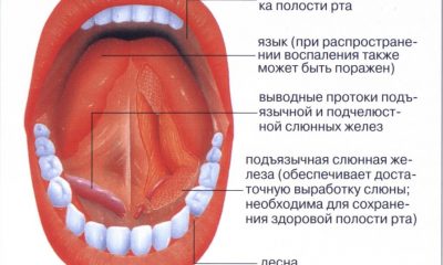 Патология полости рта